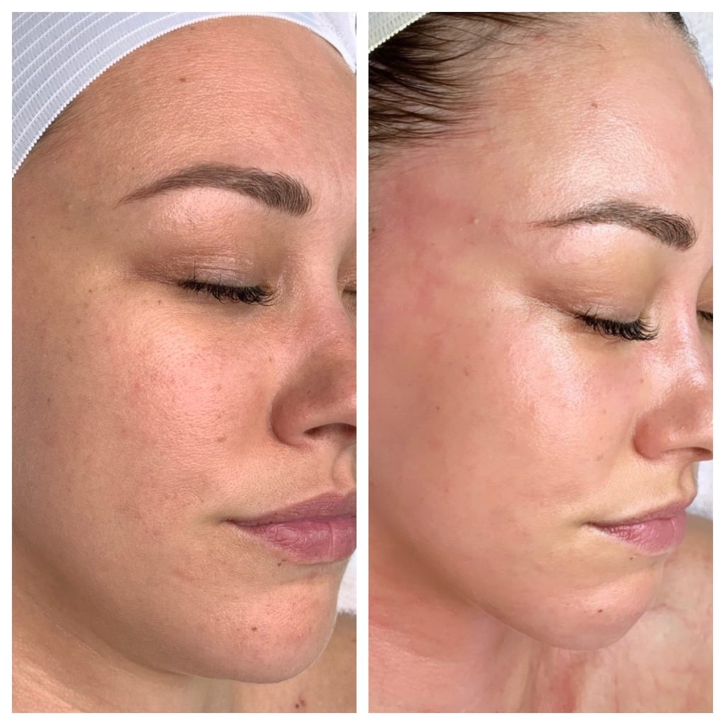 Enzyme Treatments My Wellness Solutions